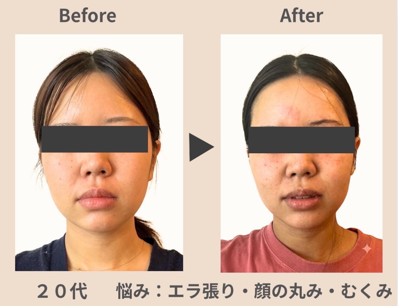 そのたるみ顔、スキンケアだけでは足りないかも…？